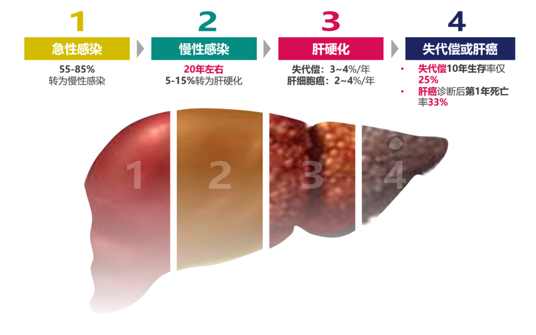 悄悄變成肝硬化、肝癌，很多人感染了卻不知道